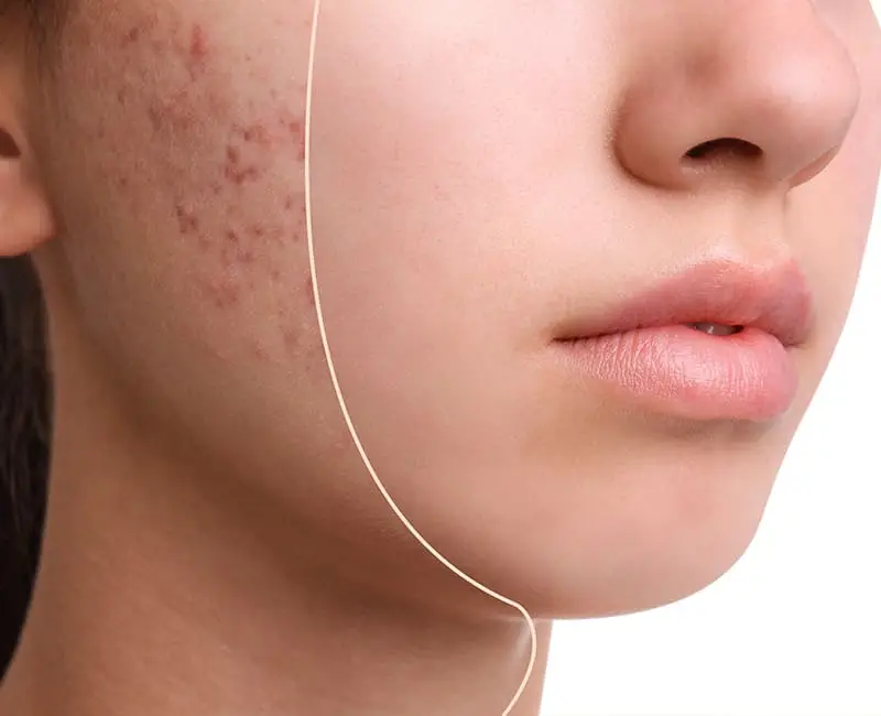 Hình ảnh chương 2